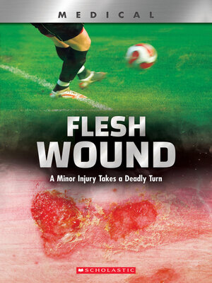 cover image of Flesh Wound